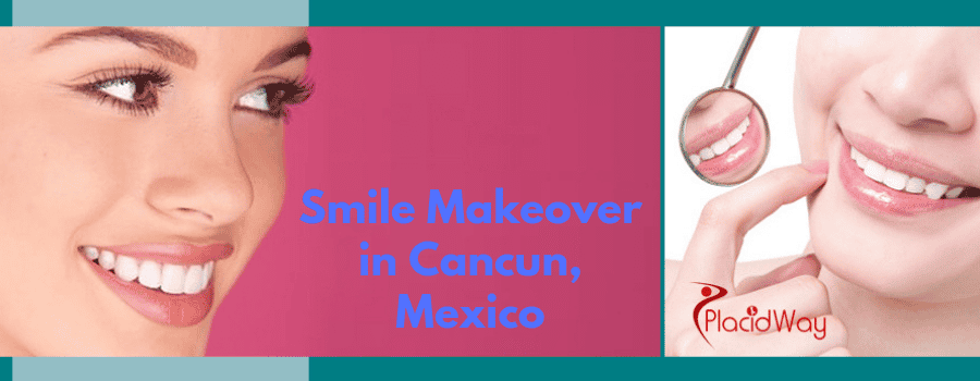 Smile Makeover in Cancun, Mexico